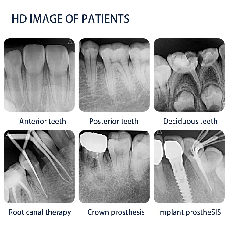 Dynamic DDT-100A Dental Digital Phosphor Plate Scanner PSP X ray Scanner